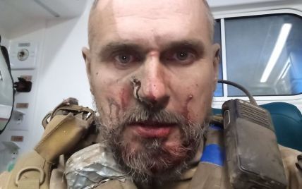‘Много раненых’: Сенцов сообщил об очередном сотрясении мозга во время боя и показал пулю из бронежилета